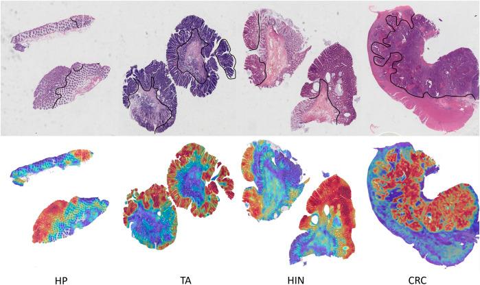 https://cdn.ncbi.nlm.nih.gov/pmc/blobs/0eeb/12179520/3a0760e9b911/fphar-16-1592950-g006.jpg