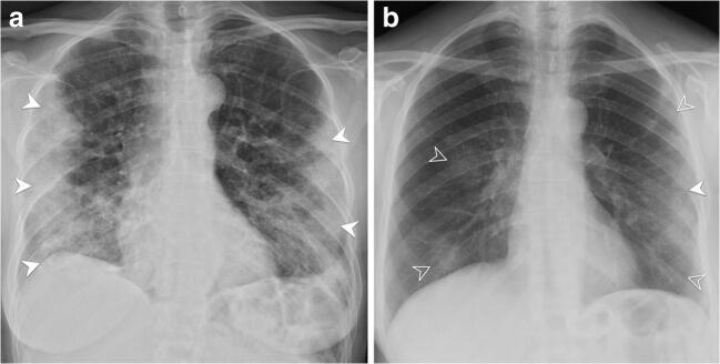 https://cdn.ncbi.nlm.nih.gov/pmc/blobs/0eec/7979644/36c030f146be/330_2020_7270_Fig2_HTML.jpg