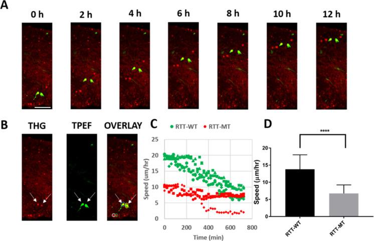 https://cdn.ncbi.nlm.nih.gov/pmc/blobs/0ef0/9337854/df9039ea614e/elife-78079-fig2-figsupp4.jpg
