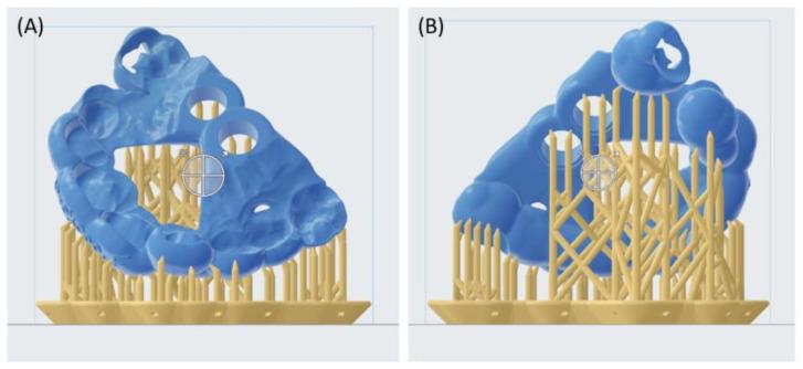 https://cdn.ncbi.nlm.nih.gov/pmc/blobs/0ef6/10813086/068475da8c62/bioengineering-11-00091-g003.jpg