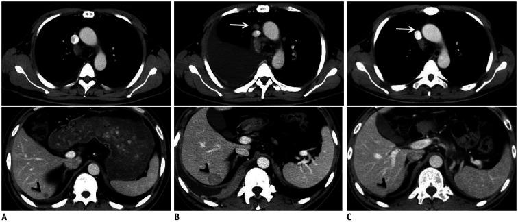 https://cdn.ncbi.nlm.nih.gov/pmc/blobs/0f02/7909853/518a72581ae2/kjr-22-366-g004.jpg