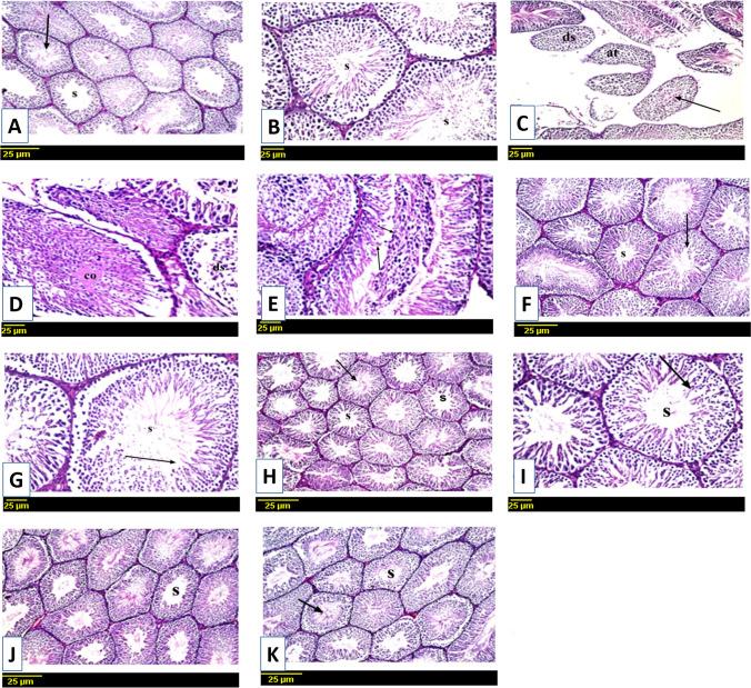 https://cdn.ncbi.nlm.nih.gov/pmc/blobs/0f05/10567954/c8408d642829/210_2023_2504_Fig2_HTML.jpg