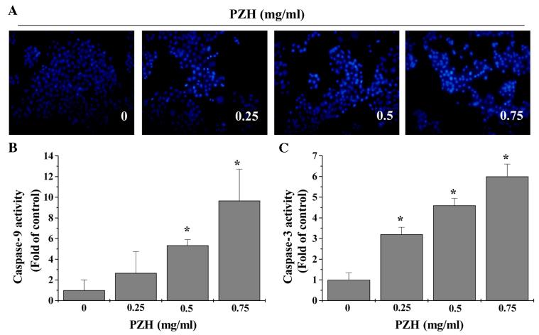 https://cdn.ncbi.nlm.nih.gov/pmc/blobs/0f09/5639424/be38f7e45473/etm-14-04-3533-g02.jpg