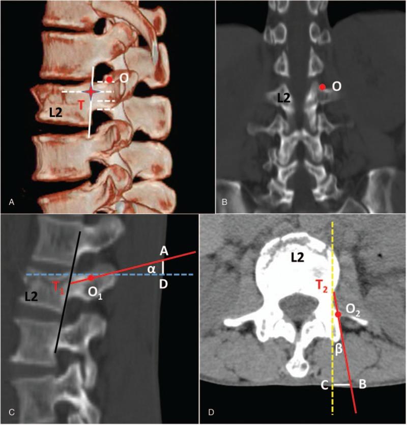 https://cdn.ncbi.nlm.nih.gov/pmc/blobs/0f09/6831313/91e23c189818/medi-98-e16792-g002.jpg