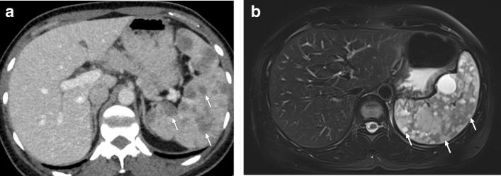 https://cdn.ncbi.nlm.nih.gov/pmc/blobs/0f0f/8160561/1f7d7da5935a/261_2021_3130_Fig27_HTML.jpg