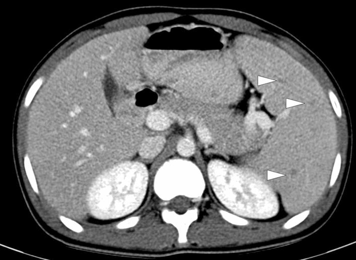 https://cdn.ncbi.nlm.nih.gov/pmc/blobs/0f0f/8160561/33a62e352265/261_2021_3130_Fig8_HTML.jpg