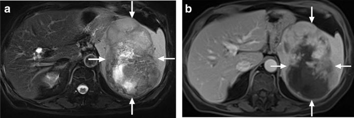 https://cdn.ncbi.nlm.nih.gov/pmc/blobs/0f0f/8160561/581a38afbf5a/261_2021_3130_Fig10_HTML.jpg