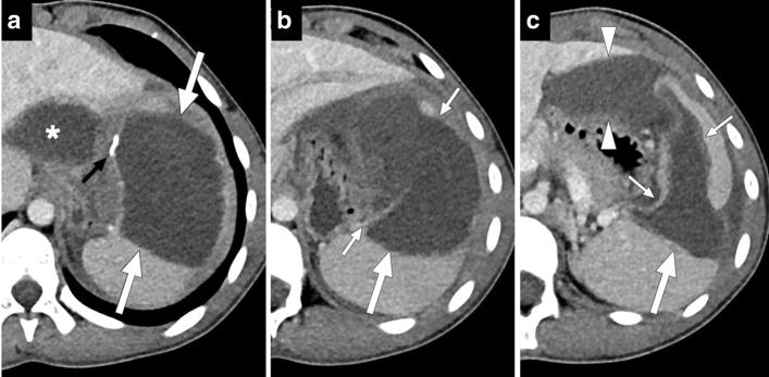 https://cdn.ncbi.nlm.nih.gov/pmc/blobs/0f0f/8160561/9c86d1f7190a/261_2021_3130_Fig14_HTML.jpg