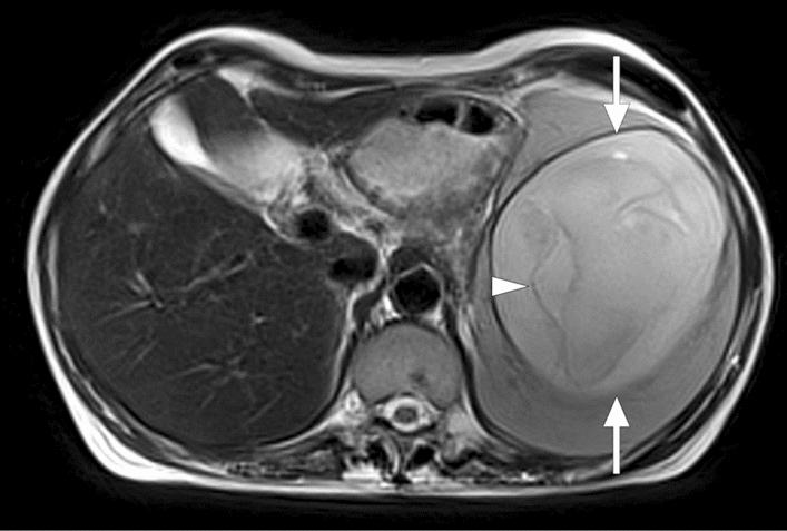 https://cdn.ncbi.nlm.nih.gov/pmc/blobs/0f0f/8160561/c7766193178c/261_2021_3130_Fig13_HTML.jpg
