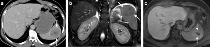 https://cdn.ncbi.nlm.nih.gov/pmc/blobs/0f0f/8160561/d85327c6c277/261_2021_3130_Fig6_HTML.jpg