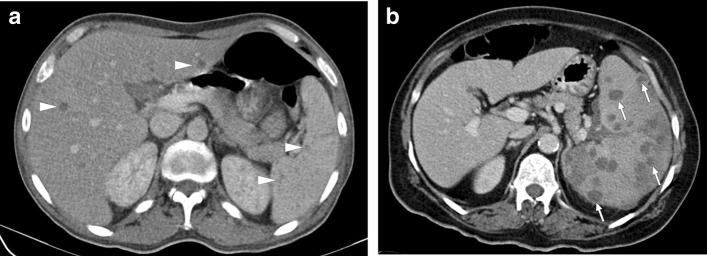 https://cdn.ncbi.nlm.nih.gov/pmc/blobs/0f0f/8160561/e8b74a25278e/261_2021_3130_Fig17_HTML.jpg