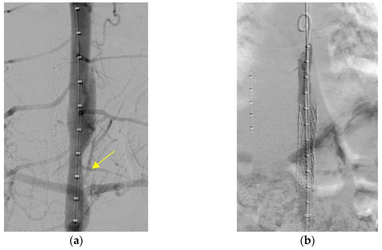 https://cdn.ncbi.nlm.nih.gov/pmc/blobs/0f11/12389546/8728734b97f8/pediatrrep-17-00084-g002.jpg