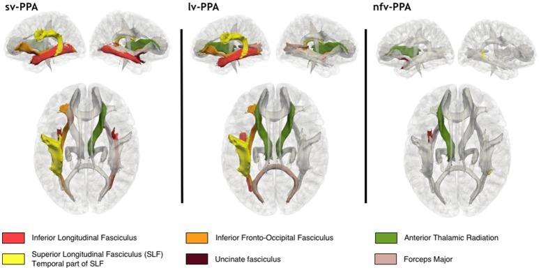 https://cdn.ncbi.nlm.nih.gov/pmc/blobs/0f11/6153366/92b5cbc90912/fneur-09-00766-g0003.jpg