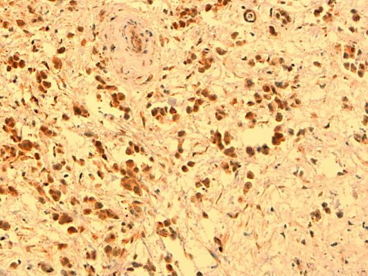 https://cdn.ncbi.nlm.nih.gov/pmc/blobs/0f19/2918860/83b6b11f6ad1/cro0002-0125-f02.jpg