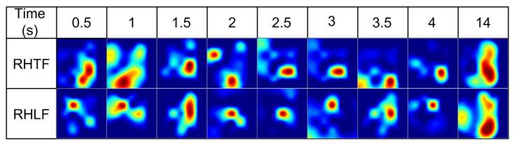 https://cdn.ncbi.nlm.nih.gov/pmc/blobs/0f23/10376657/1ef1c8f38c45/bioengineering-10-00810-g002.jpg
