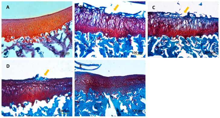 https://cdn.ncbi.nlm.nih.gov/pmc/blobs/0f25/11171648/090da5b061be/ijms-25-05673-g009.jpg