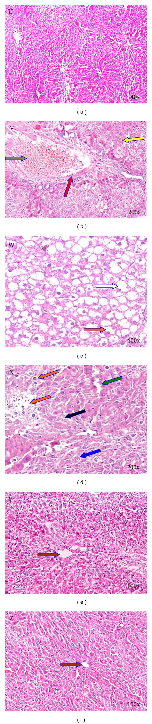 https://cdn.ncbi.nlm.nih.gov/pmc/blobs/0f25/3984823/ff7e0ad5c956/ECAM2014-641597.002.jpg