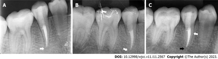 https://cdn.ncbi.nlm.nih.gov/pmc/blobs/0f27/10130992/9075711568d1/WJCC-11-2567-g005.jpg