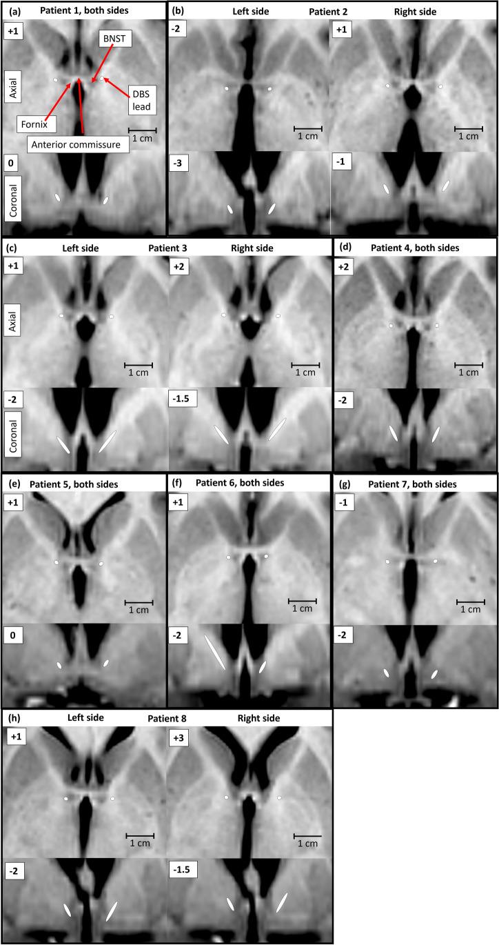 https://cdn.ncbi.nlm.nih.gov/pmc/blobs/0f2a/10140080/e921f02aa110/701_2022_5351_Fig2_HTML.jpg