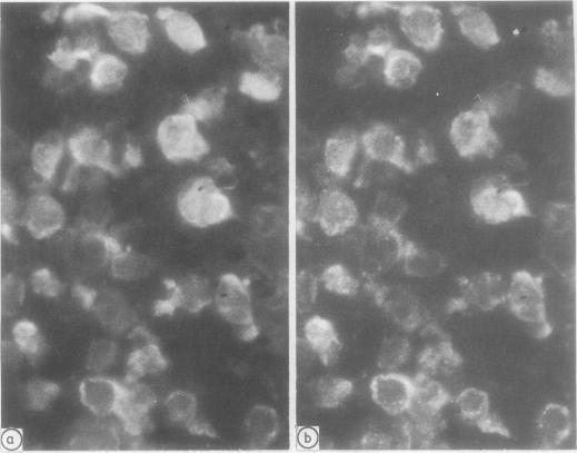https://cdn.ncbi.nlm.nih.gov/pmc/blobs/0f31/1141653/77696dcb976e/jclinpath00341-0042-a.jpg
