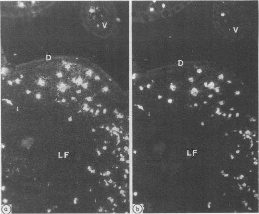 https://cdn.ncbi.nlm.nih.gov/pmc/blobs/0f31/1141653/b45e853f2d96/jclinpath00341-0043-a.jpg