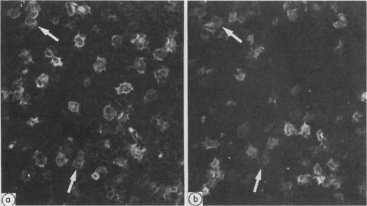 https://cdn.ncbi.nlm.nih.gov/pmc/blobs/0f31/1141653/ebabf127e6ce/jclinpath00341-0041-b.jpg