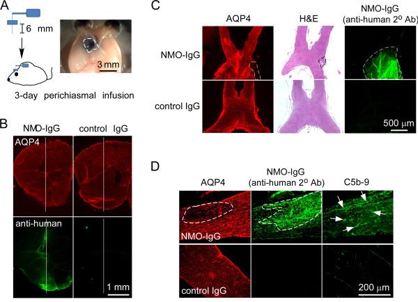 https://cdn.ncbi.nlm.nih.gov/pmc/blobs/0f32/3909205/93bfe835a4d7/1742-2094-11-16-2.jpg
