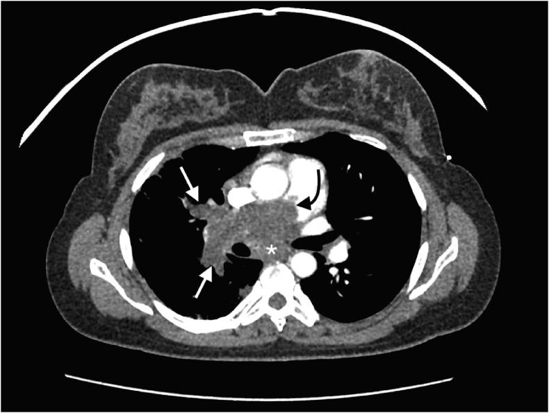 https://cdn.ncbi.nlm.nih.gov/pmc/blobs/0f37/6538954/5c3c46cd3682/gr2.jpg