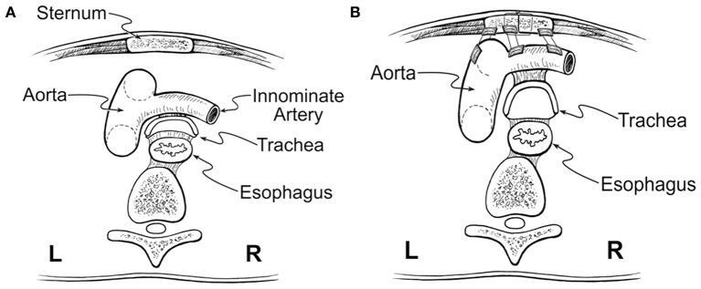 https://cdn.ncbi.nlm.nih.gov/pmc/blobs/0f40/6922019/06ebe3fc36f6/fped-07-00512-g0004.jpg
