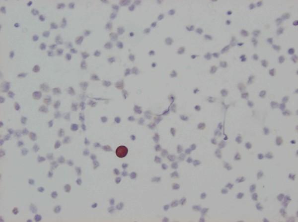 https://cdn.ncbi.nlm.nih.gov/pmc/blobs/0f44/3488538/2906b24d4938/1471-2407-12-403-2.jpg