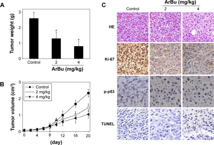 https://cdn.ncbi.nlm.nih.gov/pmc/blobs/0f46/5338965/0e6db041f538/ott-10-1261Fig6.jpg