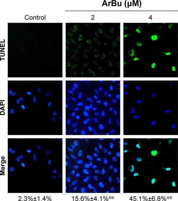 https://cdn.ncbi.nlm.nih.gov/pmc/blobs/0f46/5338965/1ff5d83b8c00/ott-10-1261Fig2.jpg
