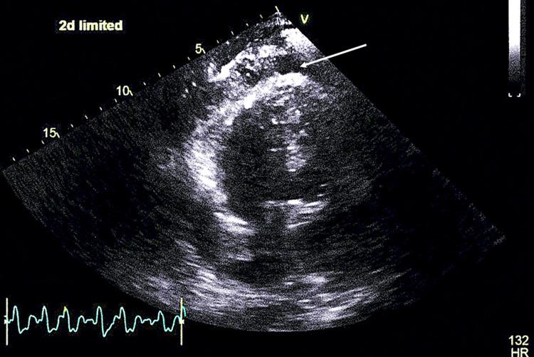 https://cdn.ncbi.nlm.nih.gov/pmc/blobs/0f49/9788795/bc6430f076e8/cureus-0014-00000031820-i05.jpg