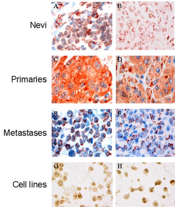 https://cdn.ncbi.nlm.nih.gov/pmc/blobs/0f4d/3341185/776238cb501c/1471-2407-12-73-1.jpg