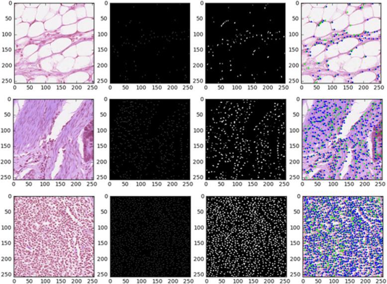 https://cdn.ncbi.nlm.nih.gov/pmc/blobs/0f53/9017017/54557dcd1476/13000_2022_1189_Fig16_HTML.jpg