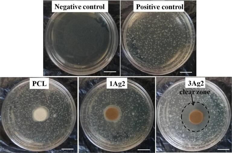 https://cdn.ncbi.nlm.nih.gov/pmc/blobs/0f56/11729033/8d0e41b023d9/gr6.jpg