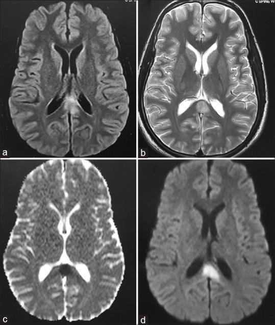https://cdn.ncbi.nlm.nih.gov/pmc/blobs/0f58/7057890/8037617feabf/AJNS-15-214-g002.jpg