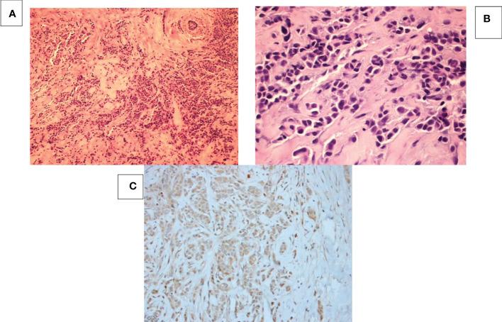 https://cdn.ncbi.nlm.nih.gov/pmc/blobs/0f5b/9850144/03563191c790/fonc-12-1061679-g002.jpg