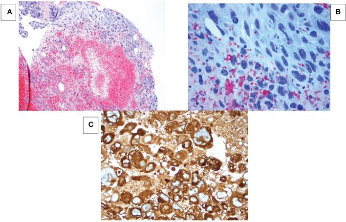 https://cdn.ncbi.nlm.nih.gov/pmc/blobs/0f5b/9850144/fdf4e29d7ddf/fonc-12-1061679-g001.jpg