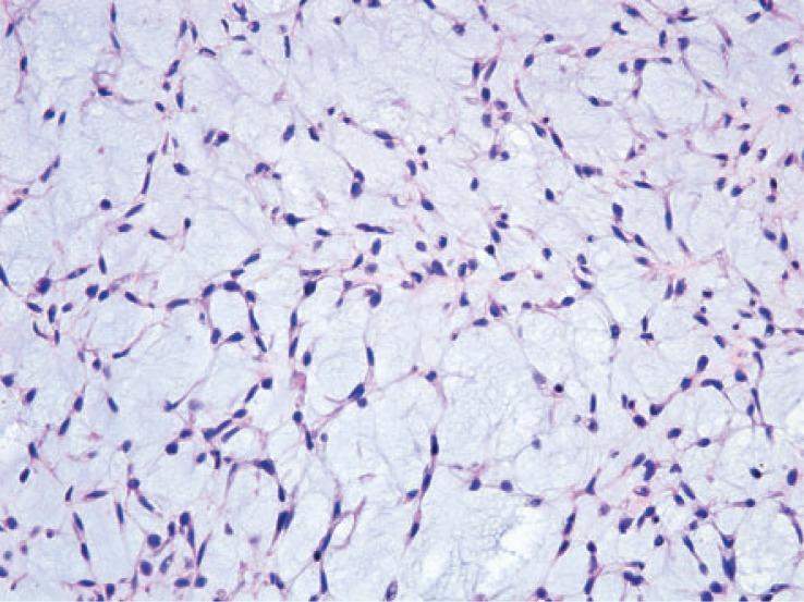 https://cdn.ncbi.nlm.nih.gov/pmc/blobs/0f6c/4110079/a4806df23d06/rado-48-03-235f4E.jpg