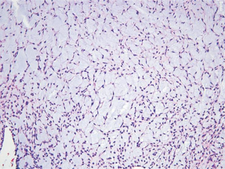 https://cdn.ncbi.nlm.nih.gov/pmc/blobs/0f6c/4110079/d2dc866171e8/rado-48-03-235f4D.jpg