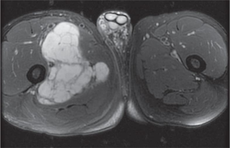 https://cdn.ncbi.nlm.nih.gov/pmc/blobs/0f6c/4110079/f2204d7c254d/rado-48-03-235f1A.jpg