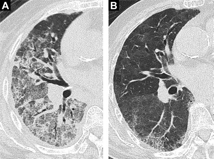 https://cdn.ncbi.nlm.nih.gov/pmc/blobs/0f6e/5695405/c6d2a80ea431/bmjopen-2016-015330f05.jpg