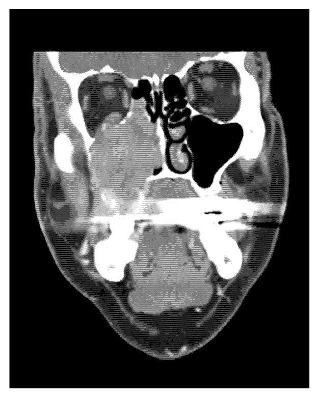 https://cdn.ncbi.nlm.nih.gov/pmc/blobs/0f72/9500801/8357c80a18ac/medicina-58-01141-g002.jpg