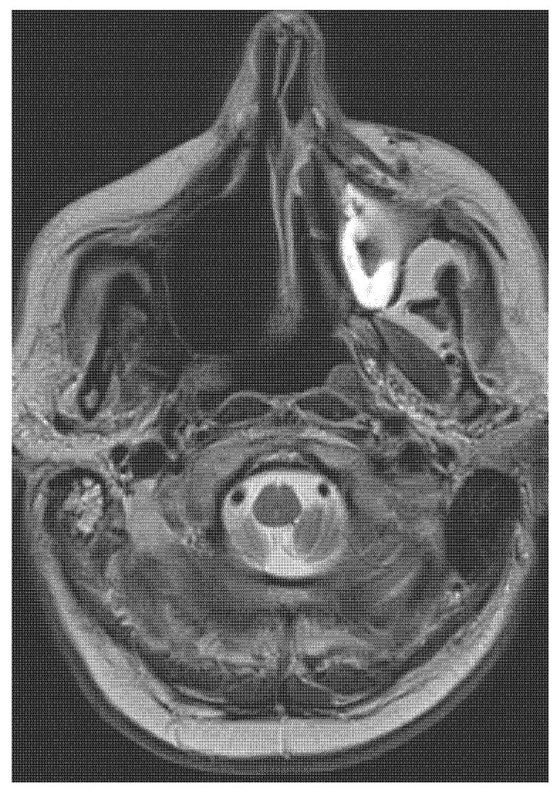 https://cdn.ncbi.nlm.nih.gov/pmc/blobs/0f72/9500801/8a771608e0d8/medicina-58-01141-g006.jpg
