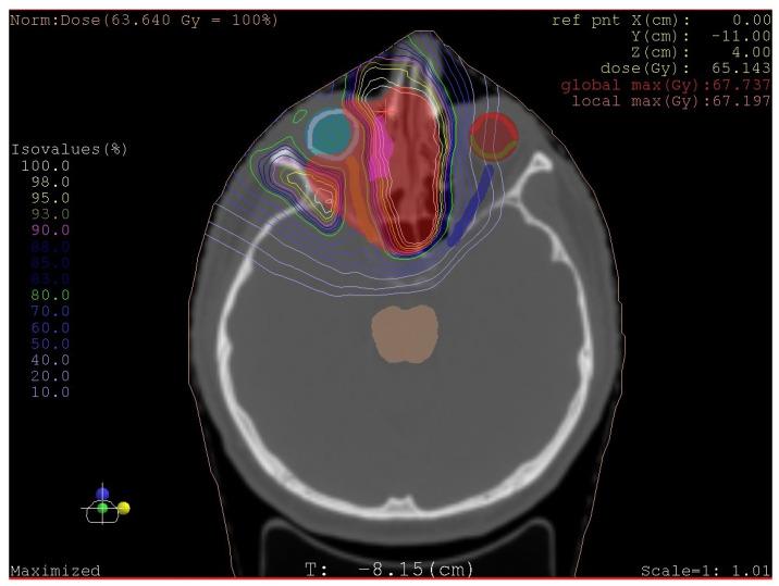 https://cdn.ncbi.nlm.nih.gov/pmc/blobs/0f72/9500801/c998d0abe608/medicina-58-01141-g005.jpg