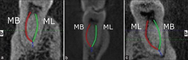 https://cdn.ncbi.nlm.nih.gov/pmc/blobs/0f74/6089042/b53fdc38cd2f/EJD-12-434-g001.jpg