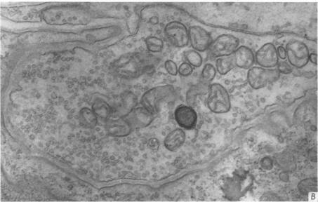 https://cdn.ncbi.nlm.nih.gov/pmc/blobs/0f77/1350481/c46577f6565f/jphysiol01086-0270-b.jpg