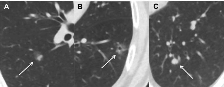 https://cdn.ncbi.nlm.nih.gov/pmc/blobs/0f78/7011883/c43fa002774c/bmjresp-2019-000455f01.jpg