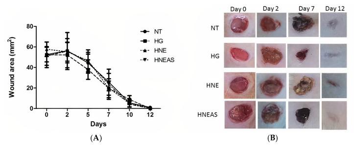 https://cdn.ncbi.nlm.nih.gov/pmc/blobs/0f78/9788587/8f24130d55e0/pharmaceutics-14-02726-g002.jpg